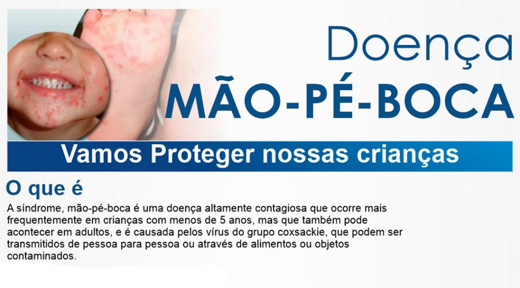 Vigilância em Saúde alerta a população sobre o contágio da virose mão ...